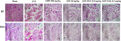 Anti-neuropathic effects of astaxanthin in a rat model of chronic constriction injury: passing through opioid/benzodiazepine receptors and relevance to its antioxidant and anti-inflammatory effects